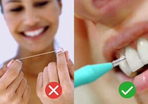 Fio dentário vs. escovilhões
